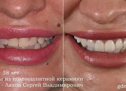 Дойти до ручки: как выбрать идеальную мебель для ванной и ничего не упустить.